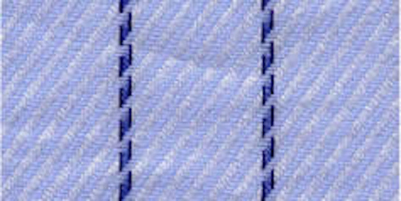 774.155